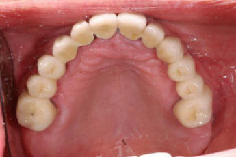 Studio Dentistico Sinagra - Genova - Impianti - Cure dentali - Denti - Otturazioni - Implantologia - Paradontologia