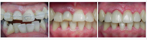 Dentista Sinagra - Genova - Impianti - Cure dentali - Denti - Otturazioni - Implantologia - Paradontologia - Carie