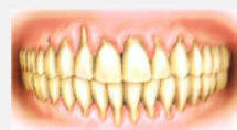 Dentista Sinagra - Genova - Impianti - Cure dentali - Denti - Otturazioni - Implantologia - Paradontologia - Carie