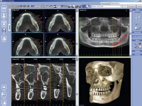 Dentista Sinagra - Genova - Impianti - Cure dentali - Denti - Otturazioni - Implantologia - Paradontologia - Carie