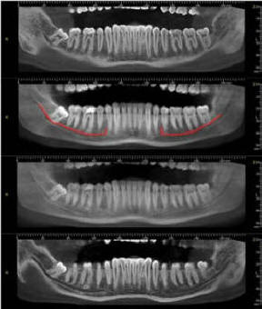 Dentista Sinagra - Genova - Impianti - Cure dentali - Denti - Otturazioni - Implantologia - Paradontologia - Carie