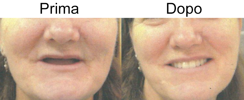 Dentista Genova, Studio Dentistico Sinagra Genova, Implantologia, Impianti, Cure dentali, Denti, Otturazioni, Paradontologia, Mal di denti