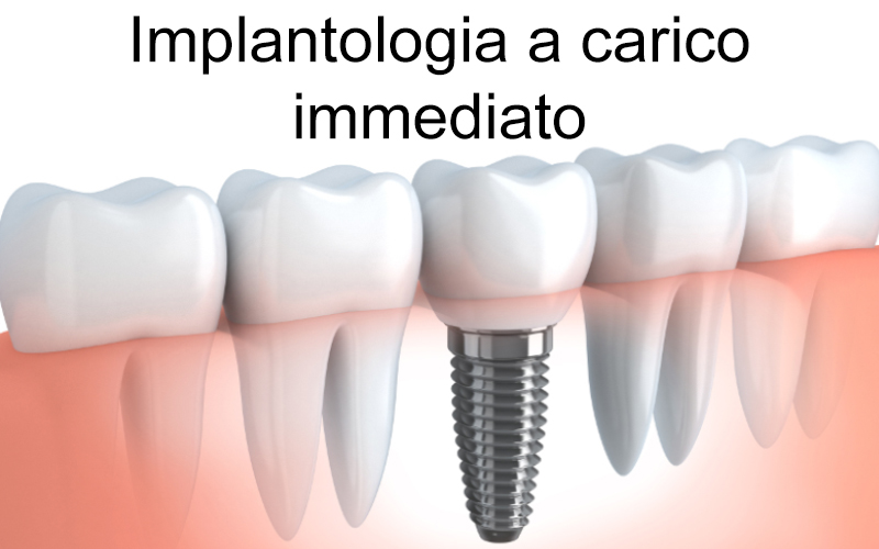 Dentista Genova, Studio Dentistico Sinagra Genova, Implantologia, Impianti, Cure dentali, Denti, Otturazioni, Paradontologia, Mal di denti
