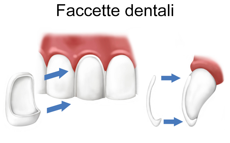Dentista Genova, Studio Dentistico Sinagra Genova, Implantologia, Impianti, Cure dentali, Denti, Otturazioni, Paradontologia, Mal di denti